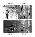 Fig. 09 - Differentiation of Bone Marrow Cells into Neuronal Cells and Uses Therefor