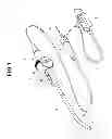Fig. 02 - Electronic endoscope in which static-protective member is provided in distal end portion of insertion portion