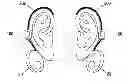 Fig. 01 - Method and apparatus for treating various neurological conditions