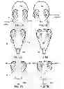 Fig. 05 - Method and apparatus for treating various neurological conditions