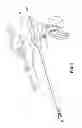 Fig. 02 - Modular surgical instrument with contained electrical or mechanical systems