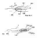 Fig. 06 - Methods and apparatus for performing renal neuromodulation via catheter apparatuses having inflatable balloons
