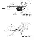 Fig. 07 - Methods and apparatus for performing renal neuromodulation via catheter apparatuses having inflatable balloons