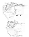 Fig. 22 - Endoscopic implant system and method