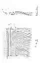 Fig. 02 - HAIR EXTENSION ASSEMBLY AND METHOD OF APPLICATION