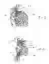 Fig. 03 - HAIR EXTENSION ASSEMBLY AND METHOD OF APPLICATION