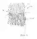 Fig. 06 - HAIR EXTENSION ASSEMBLY AND METHOD OF APPLICATION