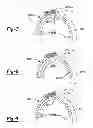Fig. 09 - Hybrid impact tool