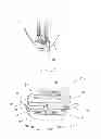 Fig. 24 - Wall rail platform and release system