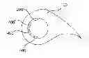Fig. 01 - ROTOR BLADE WITH HEATING DEVICE FOR A WIND TURBINE