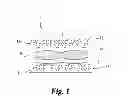 Fig. 02 - Isolated extracellular matrix material including subserous fascia