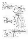 Fig. 07 - Cerclage system for bone
