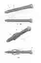 Fig. 02 - EXPANDABLE BONE FIXATION ELEMENT