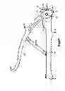 Fig. 07 - Securing device to secure fixation devices to bone portions