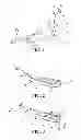 Fig. 02 - Casement window operator with folding handle