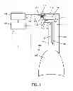 Fig. 02 - Methods, systems and devices for non-invasive open ventilation for treating airway obstructions
