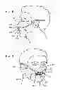 Fig. 06 - Methods, systems and devices for non-invasive open ventilation for treating airway obstructions