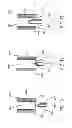 Fig. 07 - Methods, systems and devices for non-invasive open ventilation for treating airway obstructions