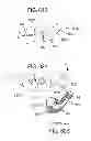 Fig. 43 - Methods, systems and devices for non-invasive open ventilation for treating airway obstructions