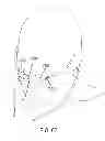 Fig. 49 - Methods, systems and devices for non-invasive open ventilation for treating airway obstructions