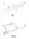 Fig. 02 - Medical Surgical Navigation Sensor Mounting System