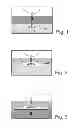 Fig. 02 - METHOD FOR LIMITING THE WATER OR GAS CONING IN AN EXTRACTION WELL OF A HYDROCARBON FLUID