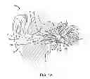 Fig. 02 - Eardrum implantable devices for hearing systems and methods