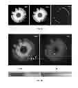 Fig. 07 - SYSTEMS AND METHODS FOR MEASURING LONGITUDINAL BRAIN CHANGE INCORPORATING BOUNDARY-BASED ANALYSIS WITH TENSOR-BASED MORPHOMETRY