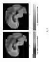 Fig. 18 - SYSTEMS AND METHODS FOR MEASURING LONGITUDINAL BRAIN CHANGE INCORPORATING BOUNDARY-BASED ANALYSIS WITH TENSOR-BASED MORPHOMETRY