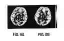 Fig. 09 - Systems and methods for accelerated arterial spin labeling using compressed sensing