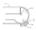 Fig. 01 - Attachment method to keep optical fiber in tension