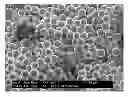 Fig. 01 - Parenteral composition comprising microspheres with a diameter between 10 and 20 microns