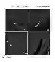 Fig. 10 - Parenteral composition comprising microspheres with a diameter between 10 and 20 microns