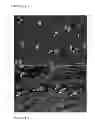 Fig. 13 - Parenteral composition comprising microspheres with a diameter between 10 and 20 microns