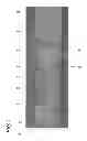 Fig. 02 - METHOD FOR SURFACE TREATMENT OF A PROTECTIVELY COATED SUBSTRATE