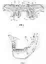Fig. 04 - Dental patient models