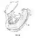 Fig. 13 - Dental patient models
