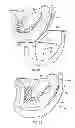 Fig. 14 - Dental patient models