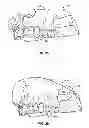 Fig. 16 - Dental patient models
