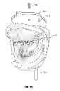 Fig. 19 - Dental patient models