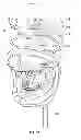 Fig. 20 - Dental patient models
