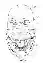 Fig. 23 - Dental patient models