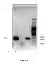 Fig. 03 - DETECTION OF INFECTION BY A MICROORGANISM USING SMALL RNA SEQUENCING SUBTRACTION AND ASSEMBLY