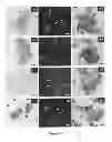 Fig. 02 - PROCESS FOR MULTI-ANALYSES OF RARE CELLS EXTRACTED OR ISOLATED FROM BIOLOGICAL SAMPLES THROUGH FILTRATION