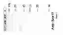 Fig. 05 - PDX1-expressing dorsal and ventral foregut endoderm