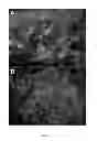 Fig. 06 - PDX1-expressing dorsal and ventral foregut endoderm