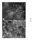 Fig. 16 - PDX1-expressing dorsal and ventral foregut endoderm