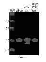 Fig. 07 - Ice-cleaved alpha-synuclein as a biomarker