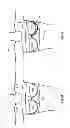Fig. 05 - Mammography brassiere