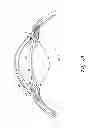 Fig. 02 - DRUG SCREENING METHOD, COMPOSITIONS AND METHODS OF TREATING GLAUCOMA